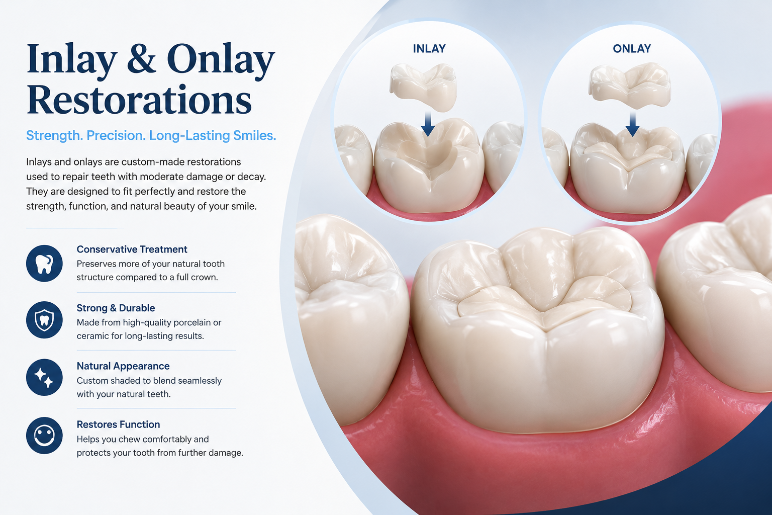 Inlay and onlay restorations for repairing damaged teeth